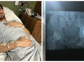 Andy Murray posted on Instagram Tuesday to say that he had gone through a hip surgery that might allow him to again play professional tennis. (Images: Andy Murray/Instagram)