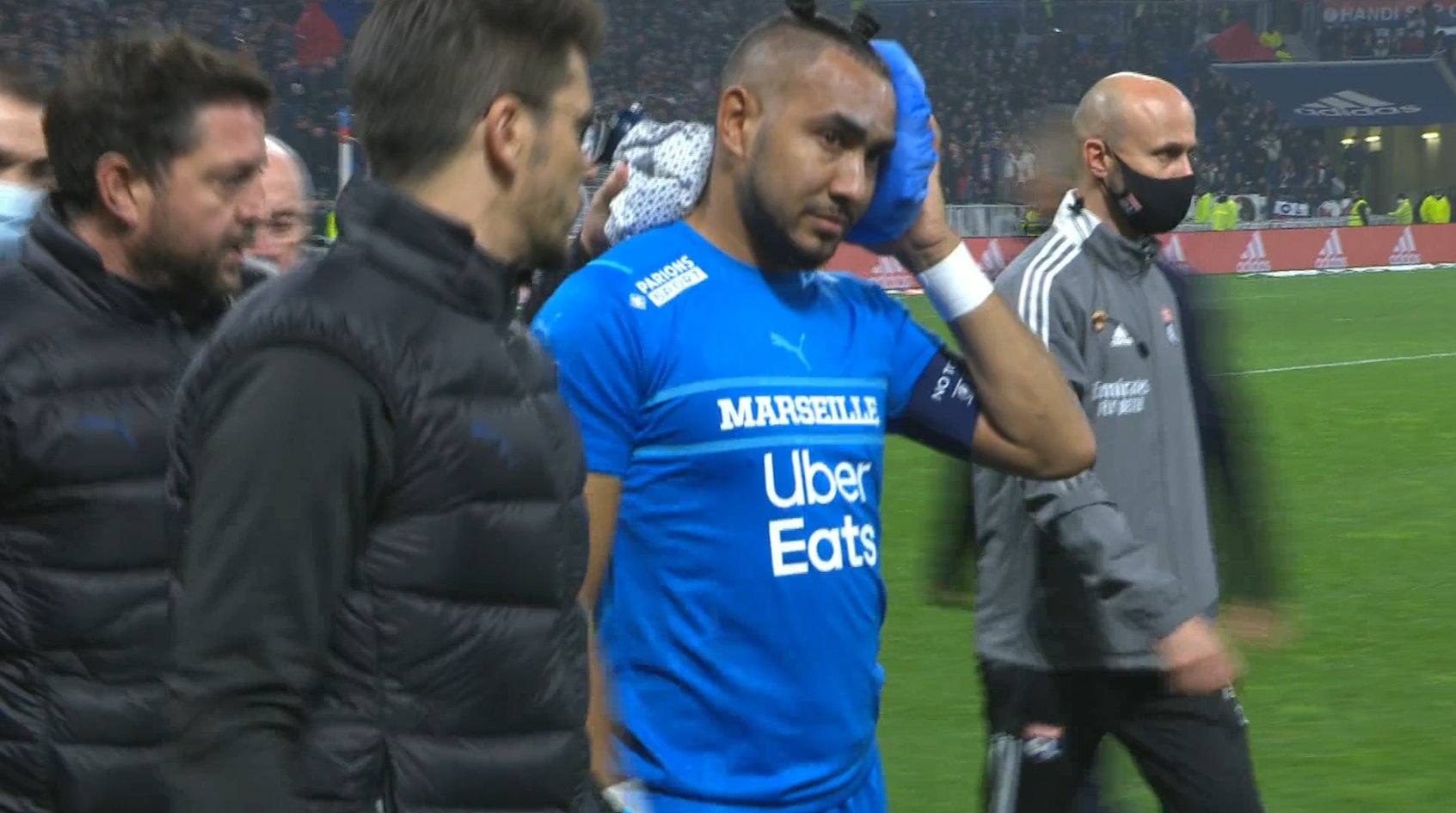 Payet hit in the head